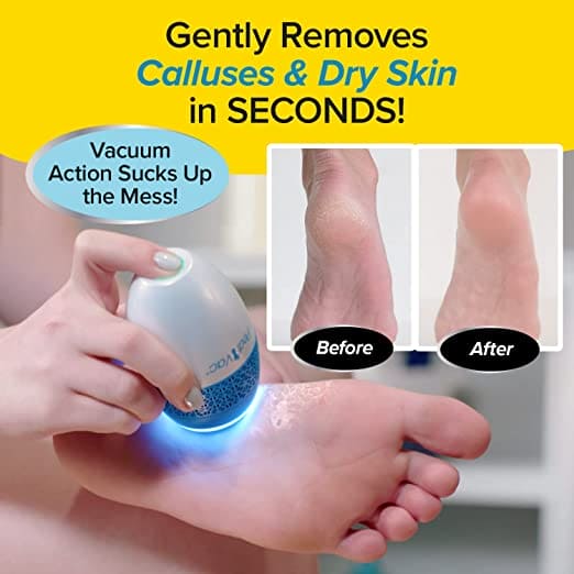 Pedi Vac Callus Remover, Callus Remover For Feet, Dead Skin Remover, Electric Callus Shaving Remover, Electric Foot File Callus Remover Pedi Vac Callus Remover, Callus Remover For Feet, Dead Skin Remover, Electric Callus Shaving Remover, Electric Foot File Callus Remover